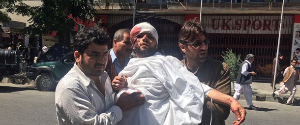 Atentado em Cabul deixa ao menos 80 mortos e mais de 100 feridos