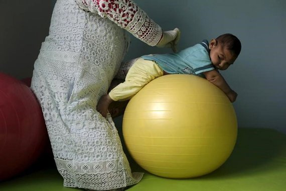 Bebê com microcefalia durante fisioterapia em Campina Grande 17/2/2016 REUTERS/Ricardo Moraes
