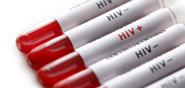 A OMS reconheceu Cuba como o primeiro país do mundo a eliminar a transmissão do vírus HIV de mãe para filho, bem como o da sífilis congênita; "O sucesso de Cuba demonstra que é possível um acesso universal à saúde e que, de fato, ele é fundamental para o êxito da luta contra desafios tão preocupantes como o HIV", disse  a diretora da Organização Panamericana da Saúde (OPS), Carissa Etiene; "A eliminação da transmissão do vírus é uma das maiores conquistas possíveis no campo da saúde", afirmou a diretora geral da OMS, Margaret Chan