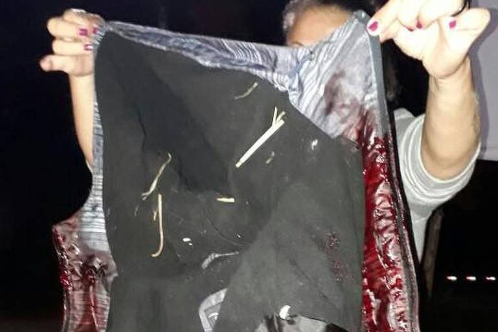 Ontem, atentado à caravana de Lula, com tiros em um dos ônibus. Hoje, mais tiros, de madrugada, em pessoas absolutamente indefesas. Um ataque covarde e inaceitável