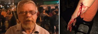 Oito pessoas ficaram feridas durante as manifestações ocorridas com a chegada por causa do ex-presidente Luiz Inácio Lula da Silva a Curitiba; três dos oito feridos são crianças, um é policial militar e os demais são manifestantes favoráveis ao ex-presidente; enquanto manifestantes gritavam por democracia, a polícia disparou balas de borracha e bombas de gás lacrimogênio; "os policiais agiram de forma criminosa", diz o deputado Marco Maia (PT-RS)
 
 