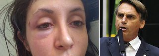 Relato da vítima viralizou nas redes. Ela conta que parou em uma padaria na rua Augusta para comer antes de ir para casa e começou a ser incomodada por um homem que, em determinado momento, perguntou em quem votaria para presidente em 2018; foi o suficiente para que o agressor, ainda não localizado, começasse a destilar ofensas racistas e preconceituosas até a acertar com um murro no olho; leia o seu relato