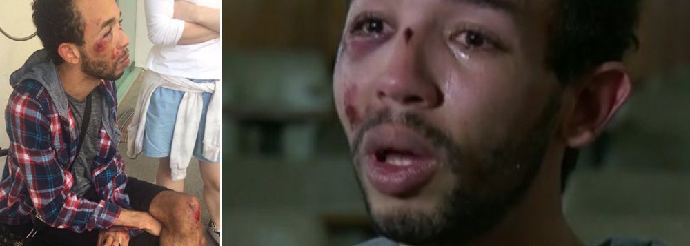 “Ele achou uma afronta eu ser um gay e querer fazer ele trabalhar às 4h da manhã”, afirmou Andrei dos Santos, que registrou ocorrência na Corregedoria Interna da Polícia Civil de Niterói (RJ). Ele acusa um agente de ter o agredido dentro da delegacia quando foi fazer um boletim de ocorrência por furto; reportagem da revista Fórum