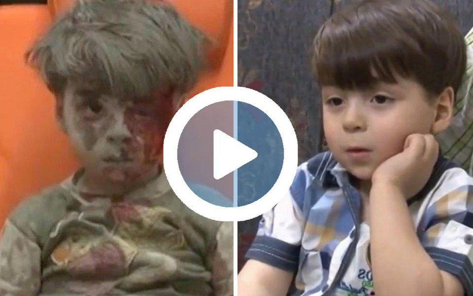 Fotografado no ano passado sujo de sangue e de poeira após ser resgatado de um bombardeio em Aleppo, Omar Daqneesh apareceu em reportagens de TV de canais da Síria, da Rússia e do Líbano; nas imagens feitas em 2017, ele aparece saudável ao lado de seu pai, que por um ano o protegeu do assédio da mídia internacional