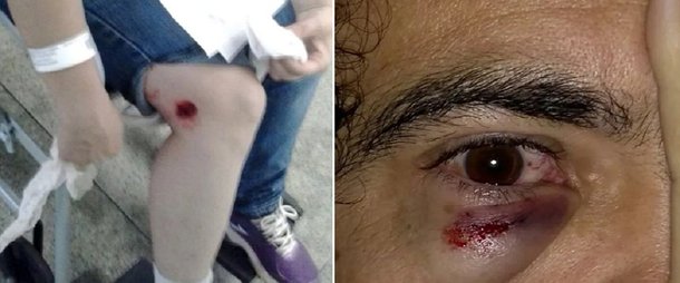 Terminou em confronto a desocupação da Secretaria Municipal de Educação, realizada na noite de quarta-feira pela Guarda Civil; prédio havia sido ocupado por professores e servidores municipais, que estão em greve, e cobram negociação por parte da prefeitura de Iris Rezende (PMDB); no meio da noite, homens da Guarda Civil entraram no prédio soltando bombas de gás e dando tiros com balas de borracha; professores ficaram feridos e foram socorridos; A prefeitura e a Guarda justificam que os servidores estavam depredando a secretaria
