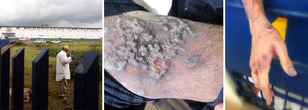 A Secretaria de Segurança Pública do Distrito Federal (SSP-DF) informou que o número de presidiários contaminados por doenças infecciosas no Complexo Penitenciário da Papuda, no Distrito Federal, aumentou 202,7% em uma semana, ao passar de 692 para 2.095 em uma semana; a contaminação atinge cinco dos seis prédio do complexo; o Ministério Público (MPDFT) enviou recomendação à SSP-DF para que medidas de combate às doenças sejam cumpridas com rigor