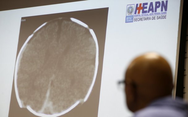 Um homem foi denunciado pelo MP-RJ à Justiça pela morte do bebê Arthur, baleado na barriga da mãe, durante um tiroteio em Duque de Caxias, na Baixada Fluminense; Romário Conceição da Silva é acusado do crime de aborto provocado por terceiros sem o consentimento da gestante; Claudineia dos Santos Melo estava grávida de nove meses quando foi atingida na barriga por um tiro, que também feriu seu feto; o bebê nasceu com vida, mas morreu um mês depois, em um hospital do município