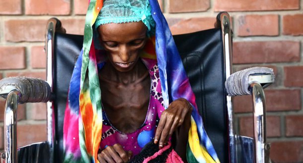 O mundo enfrenta hoje sua maior crise humanitária desde 1945 (fim da Segunda Guerra Mundial), com mais de 20 milhões de pessoas em quatro países enfrentando as agruras da fome, segundo alertou o chefe humanitário da ONU, Stephen O'Brien