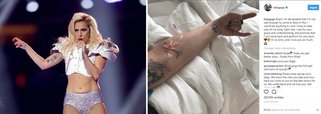 A cantora norte-americana Lady Gaga anunciou nesta quinta-feira (14) o cancelamento da sua apresentação no Rock in Rio, prevista para sexta-feira, como abertura do festival na capital carioca; a artista desistiu do show por conta de uma doença chamada fibromialgia, cujos efeitos são fortes dores musculares em todo o corpo; a cantora será substituída pela banda Maroon 5