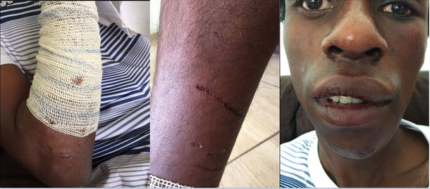 Vídeos das câmaras de segurança do terminal Dom Pedro II, na região central de São Paulo, captaram o momento em que o ator Diogo Cintra (24) é agredido por desconhecidos; imagens mostram os seguranças do terminal assistindo a cena passivamente sem tentar impedir as agressões; jovem acusou os seguranças do terminal de racismo por terem se negado a ajudá-lo mesmo após ele dizer que estava sendo vítima de um assalto e perseguido por três desconhecidos; diante da repercussão, a Secretaria Municipal de Transportes afastou os agentes envolvidos no episódio; medida, porém, foi tomada quatro dias após o crime