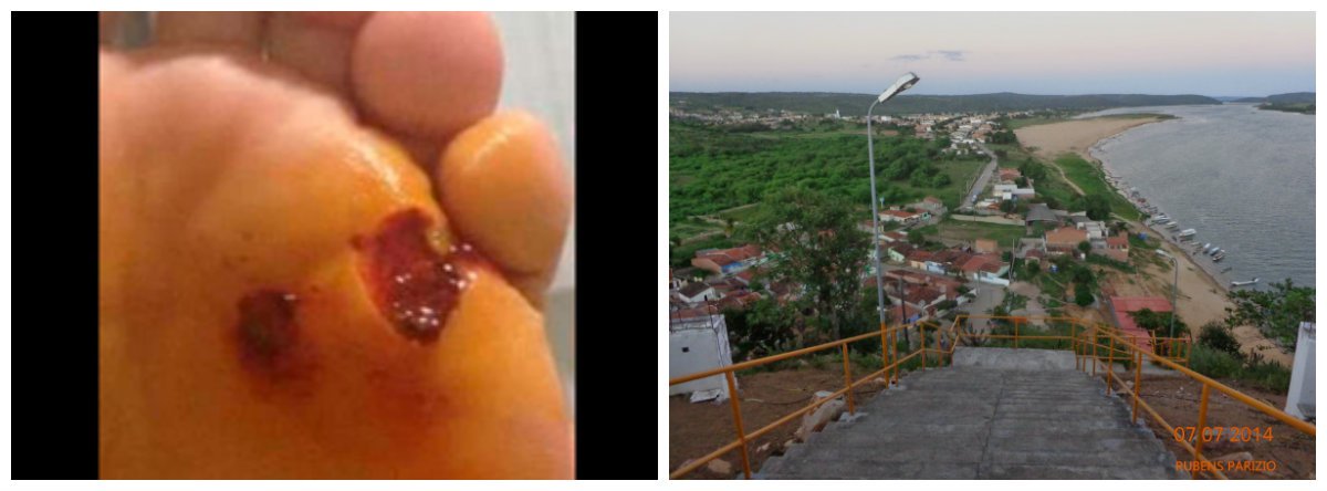 Uma jovem do município de Pão de Açúcar, no Sertão de Alagoas, foi atacada por uma piranha branca em um trecho do Rio São Francisco; pelo menos cinco pessoas também sofreram mordeduras nos pés após se banhar nas águas do rio este mês; de acordo com ambientalistas, os ataques das piranhas ocorrem devido aos impactos ambientais provocados pela redução das vazões das barragens de Sobradinho e Xingó