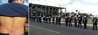 O presidente do Sindicato dos Policiais Civis na Bahia, Marcos Maurício, tomou um tiro de bala de borracha da Polícia Militar no protesto contra Michel Temer nesta quarta-feira em Brasília; apesar da agressão, o policial afirmou que a categoria vai intensificar as manifestações contra as reformas propostas pelo governo, e relatou as cenas de guerra que assistiu; "Hoje vivemos uma cena de guerra. A PM avançou nas áreas destinadas aos manifestantes e agrediu mulheres, crianças, estudantes e policiais civis com bomba de gás lacrimogêneo e balas de borracha. Um verdadeiro atentado ao Estado Democrático e de Direito", disse Marcos Maurício