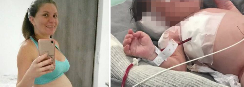 Baleado ainda na barriga da mãe, Claudineia dos Santos Melo, o recém-nascido Arthur está em estado muito grave, de acordo com a Secretaria Municipal de Saúde de Duque de Caxias; na sexta, a mãe, então grávida de nove meses, e o bebê foram atingidos por um tiro, que atravessou o tórax do bebê, deixando-o paraplégico