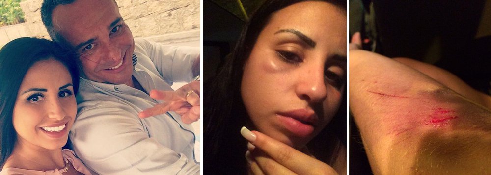 Atriz e modelo Jéssica França Ferreira, de 24 anos, foi agredida, e acusa dois porteiros do prédio onde ela morava com o ex-marido, o ator Hugo Gross, em Curicica, Zona Oeste do Rio, de serem os autores dos golpes; segundo ela, a agressão ocorreu após uma briga do casal; ela teria ido buscar suas coisas no apartamento do ator, mas teria sido impedida de entrar no local por dois porteiros que estavam de plantão; segundo a vítima, os funcionários do prédio informaram que foi Hugo ediu para bater nela, caso ela insistisse entrar no apartamento; "Estou toda arrebentada, não quero mais isso para a minha vida", acrescentou