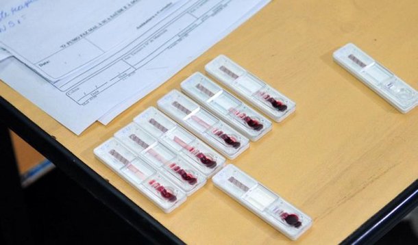 A Secretaria de Saúde confirmou 16.926 moradores de Brasília com dengue — doença transmitida pelo Aedes aegypti — desde janeiro; os dados constam do Informativo Epidemiológico nº 30; de acordo com o levantamento, outras 2.167 pessoas, de outras unidades da Federação, foram diagnosticadas na rede pública do Distrito Federal; os casos apresentados no boletim são de até 23 de julho; Brazlândia é a região administrativa com o maior número de infectados: 1.929