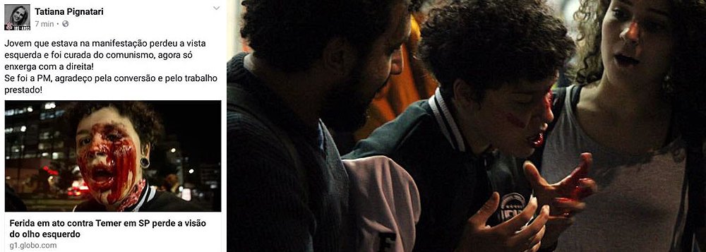 "Jovem que estava na manifestação perdeu a vista esquerda e foi curada do comunismo, agora só enxerga com a direita! Se foi a PM, agradeço pela conversão e pelo trabalho prestado", postou Tatiana Pignatari, sobre a universitária Deborah Fabri, que foi ferida durante ato contra Temer na Paulista