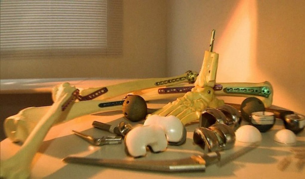 Gravações mostram um empresário investigado no esquema conhecido como a "Máfia das Próteses" combinando o saque de dinheiro que supostamente era pago a integrantes do grupo; a Polícia Civil monitora pelo menos deste maio um dos donos da empresa fornecedora de material hospitalar TM Medical Micael Alves; ele foi preso na operação Mr. Hyde, que investiga  pagamento de propina a médicos e hospitais, resultando em cirurgias e implantes desnecessários e de baixa qualidade; de acordo com a polícia, o esquema movimento R$ 30 milhões nos últimos cinco anos.