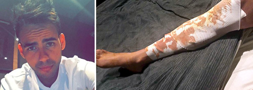 Entre as dezenas de feridos no atentado em Nice, na França, está o brasileiro Anderson Happel (24), que foi atingido pelo para-choque do caminhão usado no ataque e acabou ferido na perna; ataque, realizado pelo franco argelino Mohamed Lahouaiej Bouhlel (31), aconteceu quando ele acelerou o caminhão em alta velocidade contra uma multidão que assistia a uma queima de fogos no balneário francês em homenagem à Queda da Bastilha; pelo menos 84 pessoas morreram a mais de 50 estão internadas em estado grave