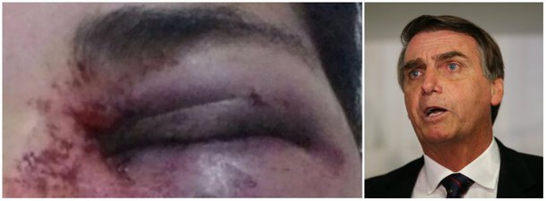 Uma jovem do Levante Popular da Juventude, do Distrito Federal, foi agredida a socos por um "admirador do Bolsonaro" em Samambaia; movimentos sociais, como o Movimento de Mulheres Camponesas (MMC), o MST e o Movimento dos Atingidos por Barragens (MAB) divulgaram nota de repúdio à agressão; "Precisamos contar essa história por acreditarmos e querermos outra sociedade", disse; a agressão foi classificada como "um ataque fascista, carregado de lesbofobia e misoginia"