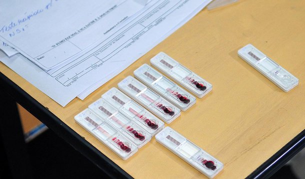 O auge dos casos da dengue ocorre normalmente em abril e em maio, fim do período de chuvas no Distrito Federal; em ambos os meses, 2015 apresentou redução das ocorrências da doença em relação aos anos antecedentes. Neste ano, o resultado é ainda melhor; o mês passado foi o com menor número de contaminações desde 2012; de acordo com a Secretaria de Saúde, apresentaram quedas, com 3.953 pessoas em março, 3.349 em abril e chegando a 1.266 em maio; em 2015, o comportamento da doença foi o contrário: em fevereiro tinha 642 casos; março, 1.057; abril, 2.934; e maio, 2.425