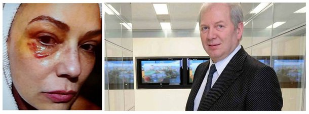 Imagem foi anexada ao processo em que a atriz acusa o ex-companheiro Lírio Parisotto, um dos homens mais ricos do Brasil, de agredi-la; “A maquiagem forte esconde o hematoma da alma”