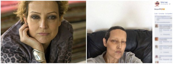 Ex-modelo lutava contra um câncer na vesícula há três anos. Betty morreu em casa, no Leblon, Zona Sul do Rio de Janeiro, por volta de 1h30