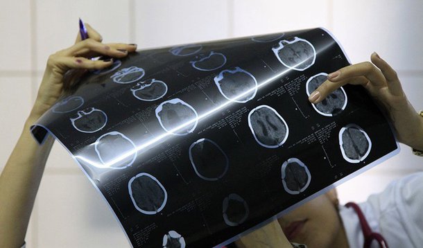 O Ministério da Saúde confirmou dois casos de microcefalia associados ao zika vírus em Brasília; outros 10 estão em investigação; de outubro até esta quarta (15), período contabilizado pelo Boletim Epidemiológico ministerial, foram registradas 37 suspeitas no DF e 25 casos foram descartados; a pasta e os estados investigam 4.268 casos suspeitos de microcefalia em todo o País, o que representa 65,9% dos casos notificados; o novo informe aponta que 2.212 casos foram investigados e classificados, sendo 1.349 descartados e 863 confirmados para microcefalia e outras alterações do sistema nervoso, sugestivos de infecção congênita