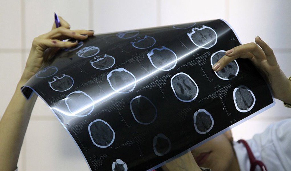 O Ministério da Saúde confirmou dois casos de microcefalia associados ao zika vírus em Brasília; outros 10 estão em investigação; de outubro até esta quarta (15), período contabilizado pelo Boletim Epidemiológico ministerial, foram registradas 37 suspeitas no DF e 25 casos foram descartados; a pasta e os estados investigam 4.268 casos suspeitos de microcefalia em todo o País, o que representa 65,9% dos casos notificados; o novo informe aponta que 2.212 casos foram investigados e classificados, sendo 1.349 descartados e 863 confirmados para microcefalia e outras alterações do sistema nervoso, sugestivos de infecção congênita