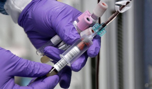 A Secretaria Estadual de Saúde do Rio de Janeiro informou que os kits para diagnosticar a dengue estão em falta no estado; de acordo com a secretaria, a responsabilidade de fornecimento dos kits é do Ministério da Saúde; mesmo assim, não há mais kits no estoque do laboratório. As amostras coletadas de pacientes com suspeita de dengue estão sendo armazenadas para que o exame seja feito posteriormente