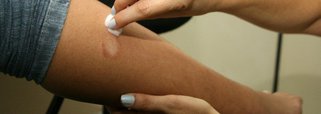 A população de 22 municípios prioritários do Maranhão poderá fazer, gratuitamente, os testes clínicos voltados para detecção da hanseníase; a Carreta da Saúde contra a Hanseníase começaram o seu roteiro no estado, em São Luís, e em seguida percorrem outros 21 municípios até 20 de abril, encerrando seu trajeto em Presidente Dutra, Centro Maranhense, a 347 km da capital; a iniciativa tem como objetivo é promover atividades de educação em saúde para alertar a população geral sobre os sinais e sintomas da hanseníase, realizar a avaliação dermatoneurológica para identificar casos novos da doença e exame de contatos, além de encaminhamento dos casos confirmados para tratamento na rede do SUS