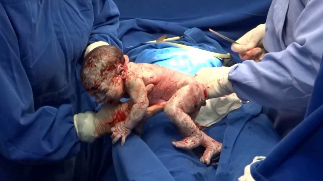 A 4ª Conferência Internacional sobre Humanização do Parto e Nascimento que é realizada até a próxima quarta-feira (30) em Brasília pretende, entre outras questões, difundir e profundar o conhecimento sobre humanização do parto, dar visibilidade a experiências exitosas de humanização e redução de cesáreas desnecessárias no Brasil e no exterior; proposta é dar visibilidade ao que vem sendo feito para tornar o parto e o nascimento experiências fortalecedoras para a mulher e para o recém-nascido