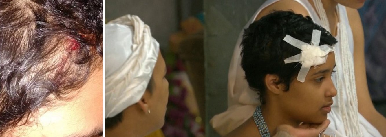 A Polícia Civil está em busca de imagens e testemunhas que possam ajudar a identificar os suspeitos de terem apedrejado uma menina de 11 anos adepta do Candomblé, por intolerância religiosa, na zona norte do Rio; o caso foi registrado na 38ª Delegacia de Polícia de Irajá, e a vítima, que está em casa, já foi ouvida e encaminhada para o exame de corpo de delito; membro da Comissão de Combate à Intolerância Religiosa (CCIR), o babalawo Ivanir dos Santos, afirmou  que a menina foi atingida na cabeça por uma pedrada, que só não causou mais ferimentos porque teria batido primeiro em um poste