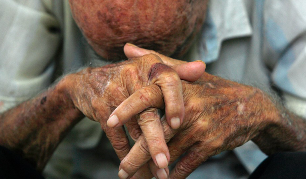 Cresce o número de idosos vítimas de violência no estado do Rio de Janeiro; levantamento do Instituto de Segurança Pública mostra que entre 2002 e 2012 o número de vítimas acima dos 60 anos cresceu 123%; passou de 29,4 mil para 66 mil; entre os crimes que mais atingem os idosos estão o estelionato, a ameaça e a lesão corporal