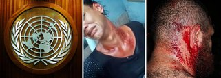 ONU se diz preocupada com violência em eleição no Brasil