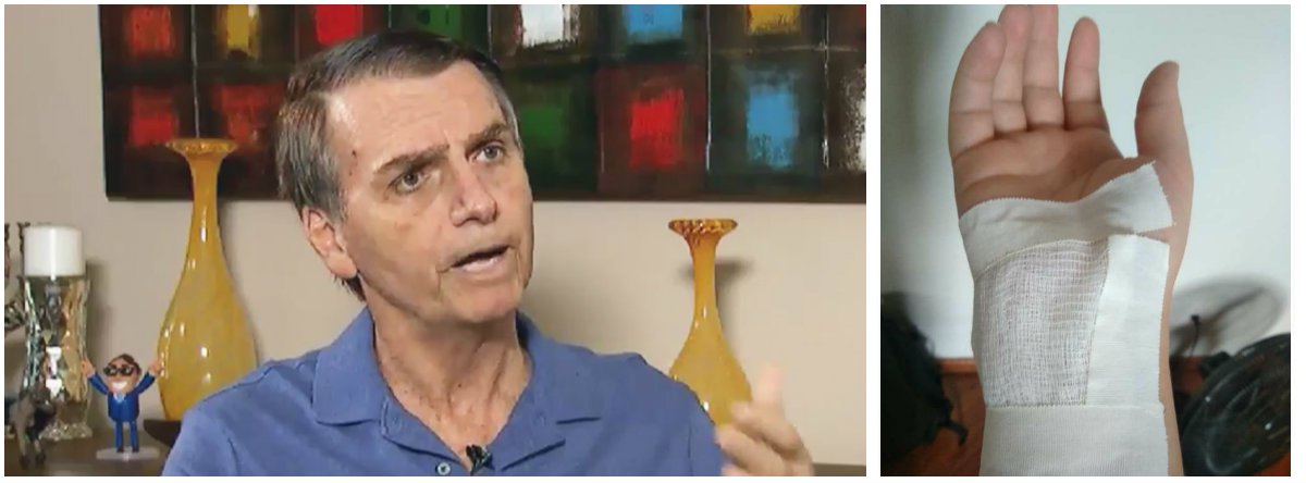 Mulher agredida diz que todo bolsonarista tem a mão suja de sangue