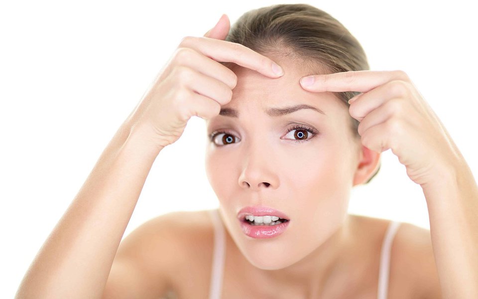 Acne. Terror dos adolescentes