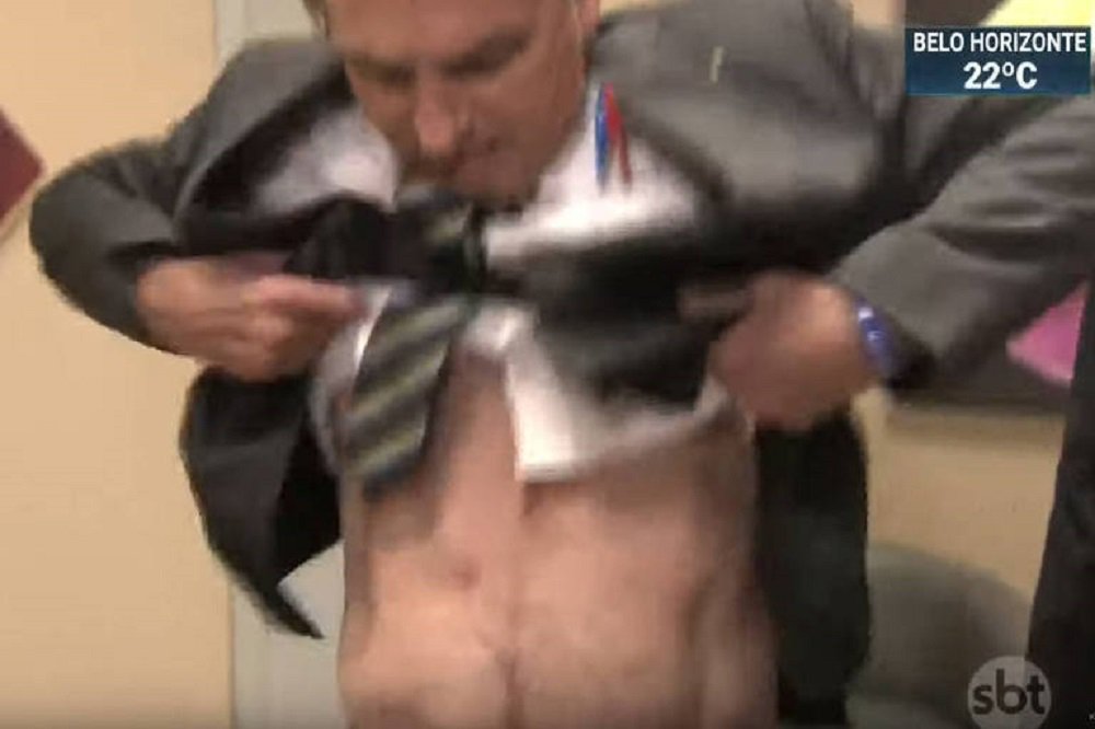 Bolsonaro mostra cicatriz na TV para dizer que facada não foi fake
