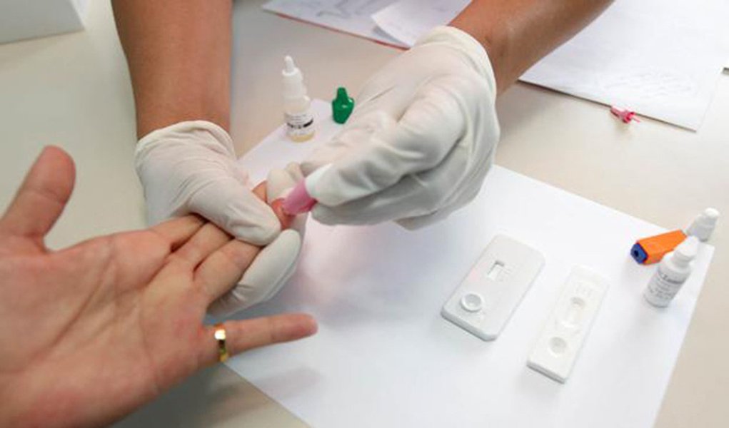 Governo oferece mil testes rápidos de HIV na semana da Parada LGBT