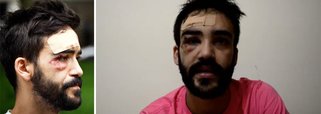 Secretaria de SP denuncia agressores por homofobia