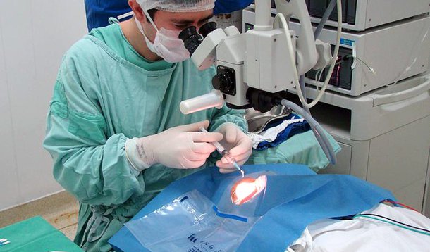 Cirurgia de catarata completa 60 anos