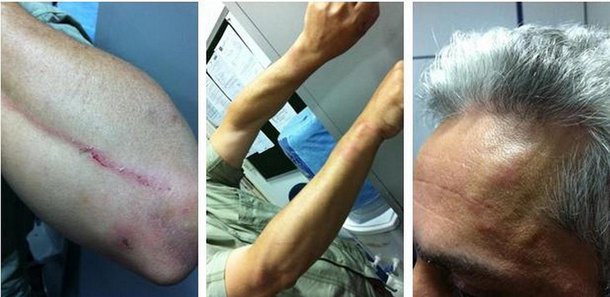 Advogado e policial trocam agressões em ocorrência na Capital