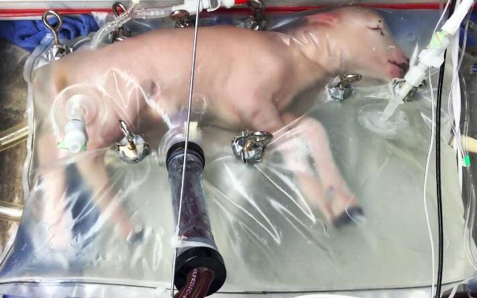 Útero artificial. Foi criado, testado, e funciona