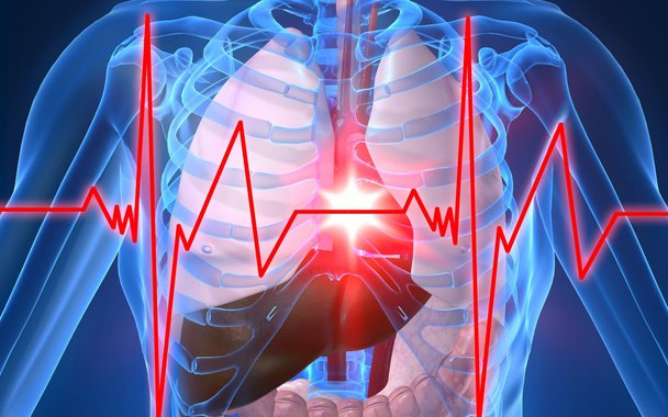 Por que as artérias entopem. Causas da aterosclerose, uma importante causa do infarto