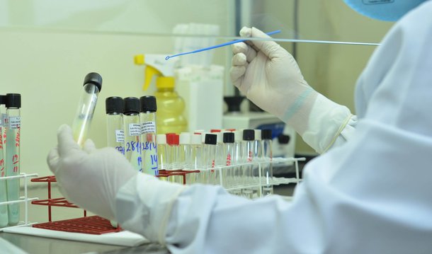 Pelo menos 12 grupos pesquisam vacina contra o Zika, diz OMS