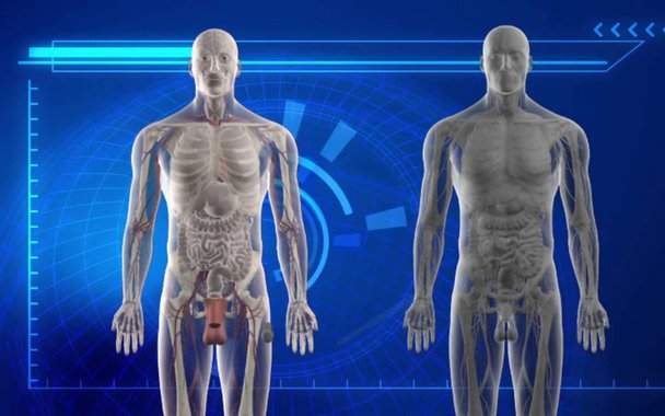 Transplante de pênis.  Cirurgia bem-sucedida após amputação por complicação decorrente de circuncisão ritual