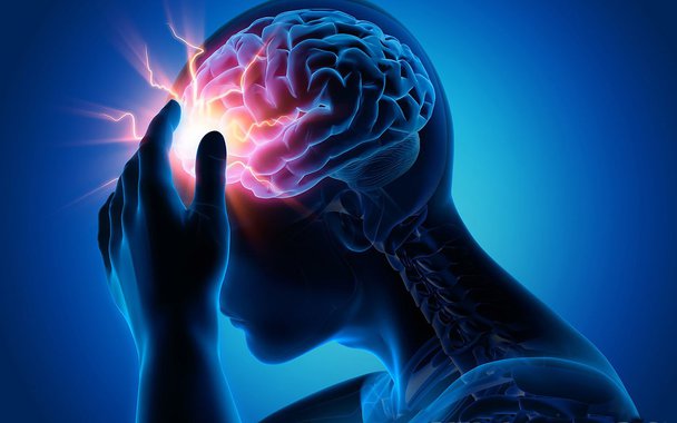 Acidente vascular cerebral. O que é preciso saber sobre o AVC