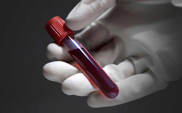 Exame de sangue. O que significam os resultados