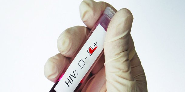 ONU diz que luta global contra Aids está em “situação precária”