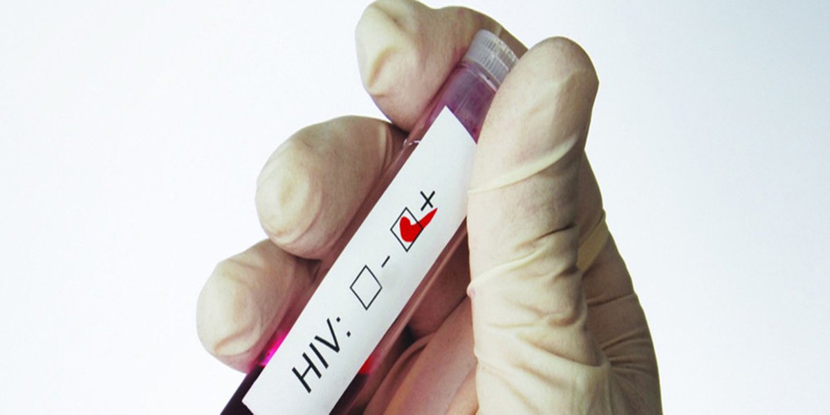 ONU diz que luta global contra Aids está em “situação precária”