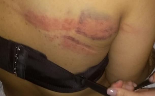 Adolescente é ferida pela Polícia em Paraisópolis em baile funk